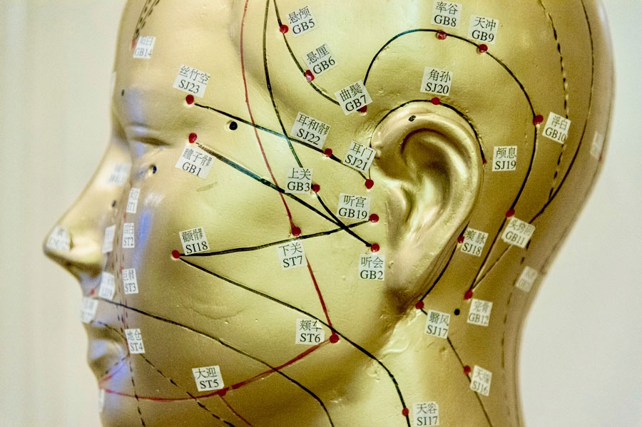 Acupuncture points on the head