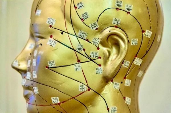 Acupuncture points on the head